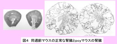 polycystic kidney disease pcy mouse PKD XEt