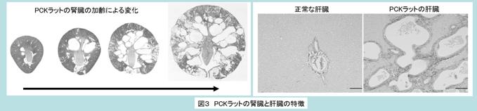 polycystic kidney disease PCK rat PKD 嚢胞腎