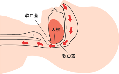 図1：患者の気道閉塞 健康人の気道