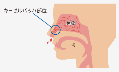 キーゼルバッハ部位