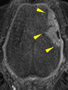 図2：MRI検査
