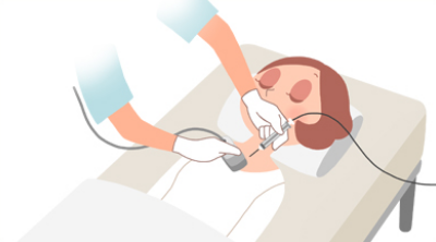 図：穿刺吸引細胞診