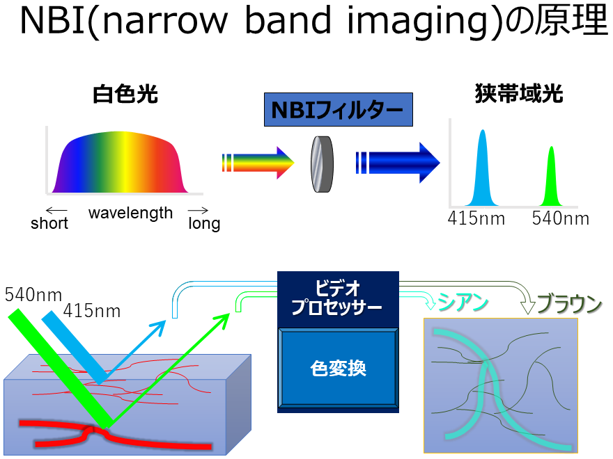 NBI（narrow band imaging）の原理