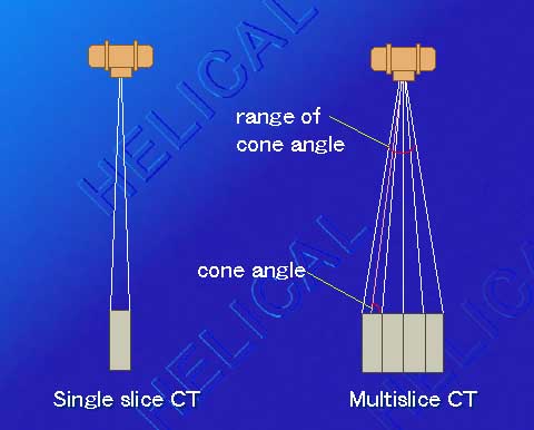 انواع اجهزة الاشعة المقطعية Cone_angle
