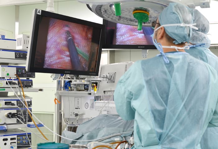 腎移植の手術風景