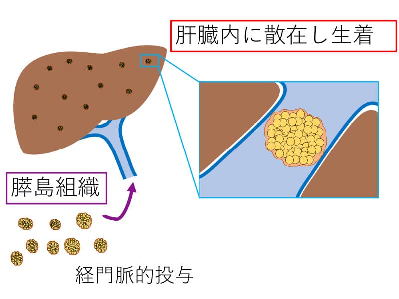 肝臓内に散在し生着