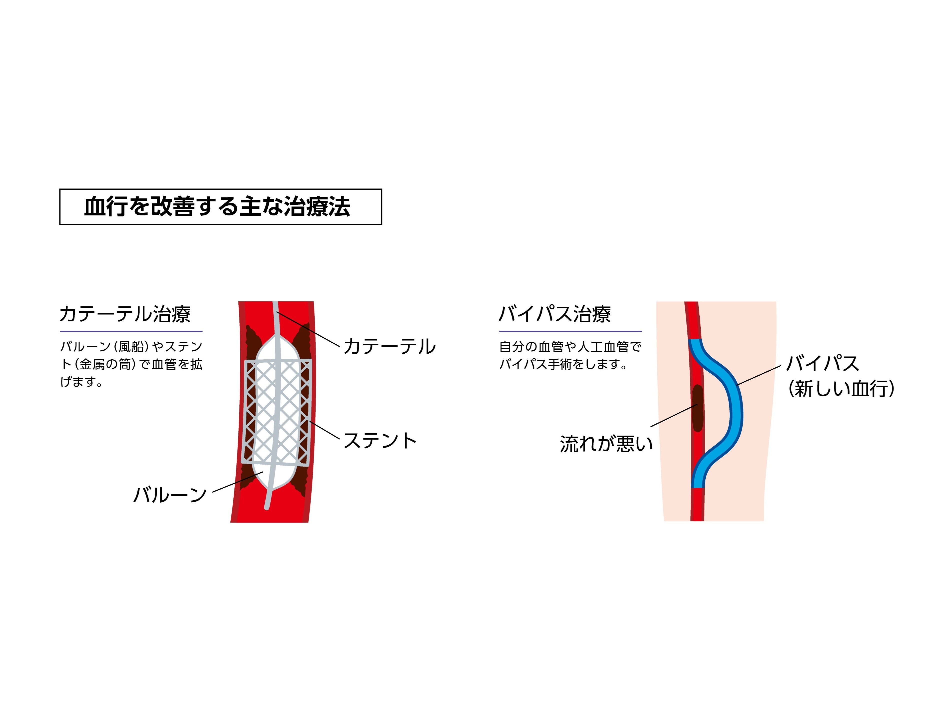 東海地方初の「足の血管センター」を新設