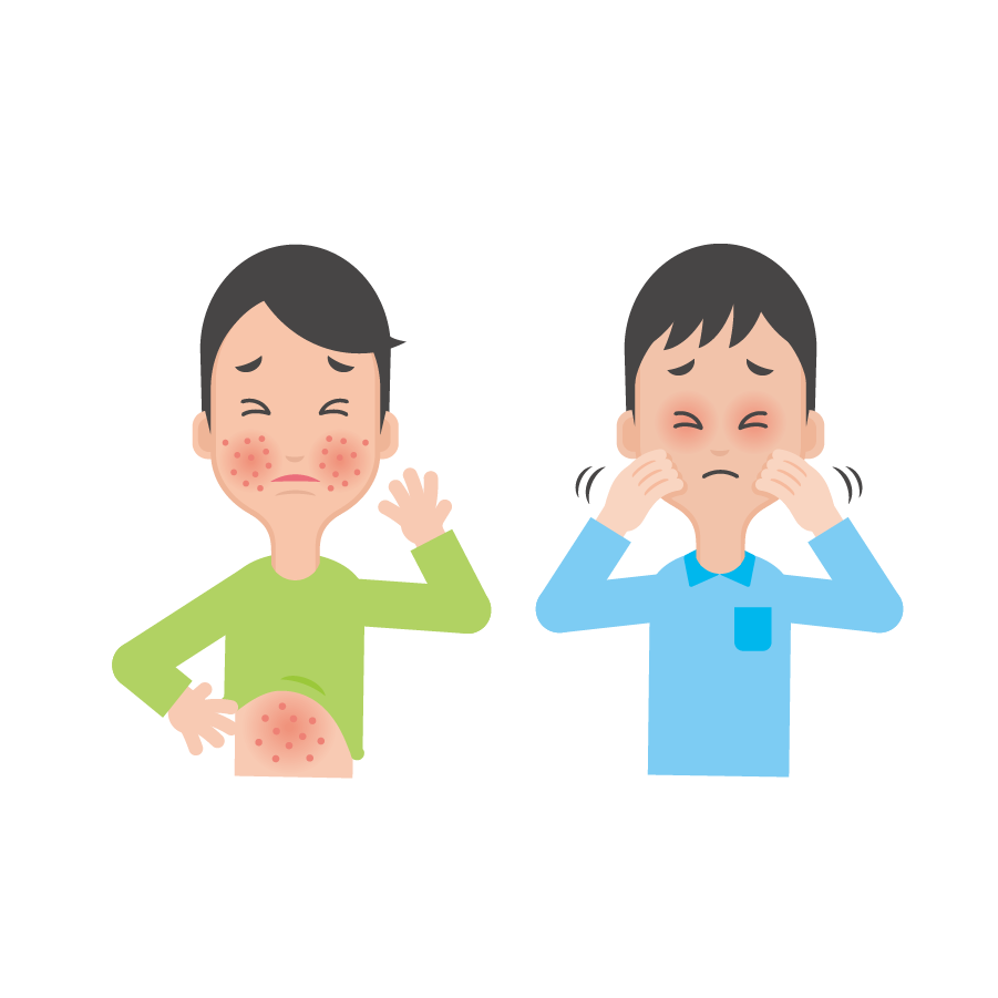 アトピー性皮膚炎の部屋