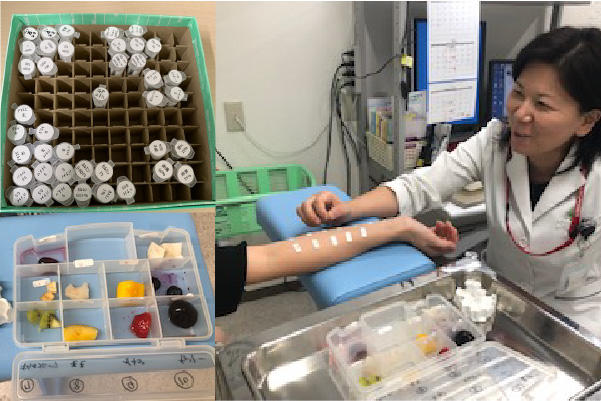 総合アレルギー科 プリックテスト