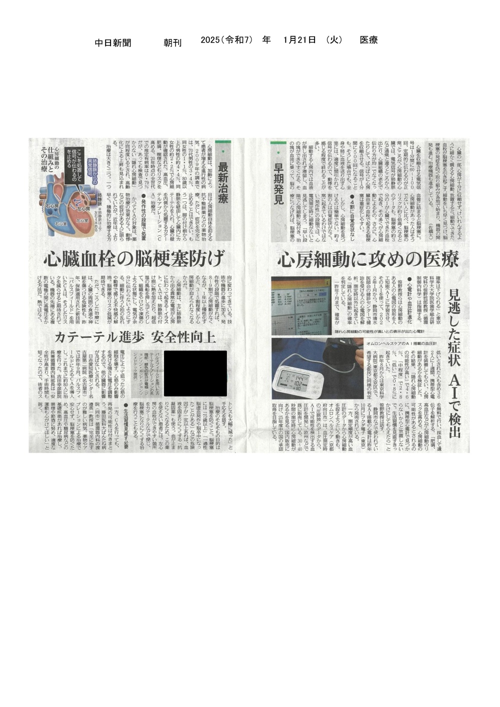 本学 ばんたね病院 渡邉英一教授が心房細動の治療についてコメントした記事が2025年1月21日中日新聞（朝刊）に掲載されました