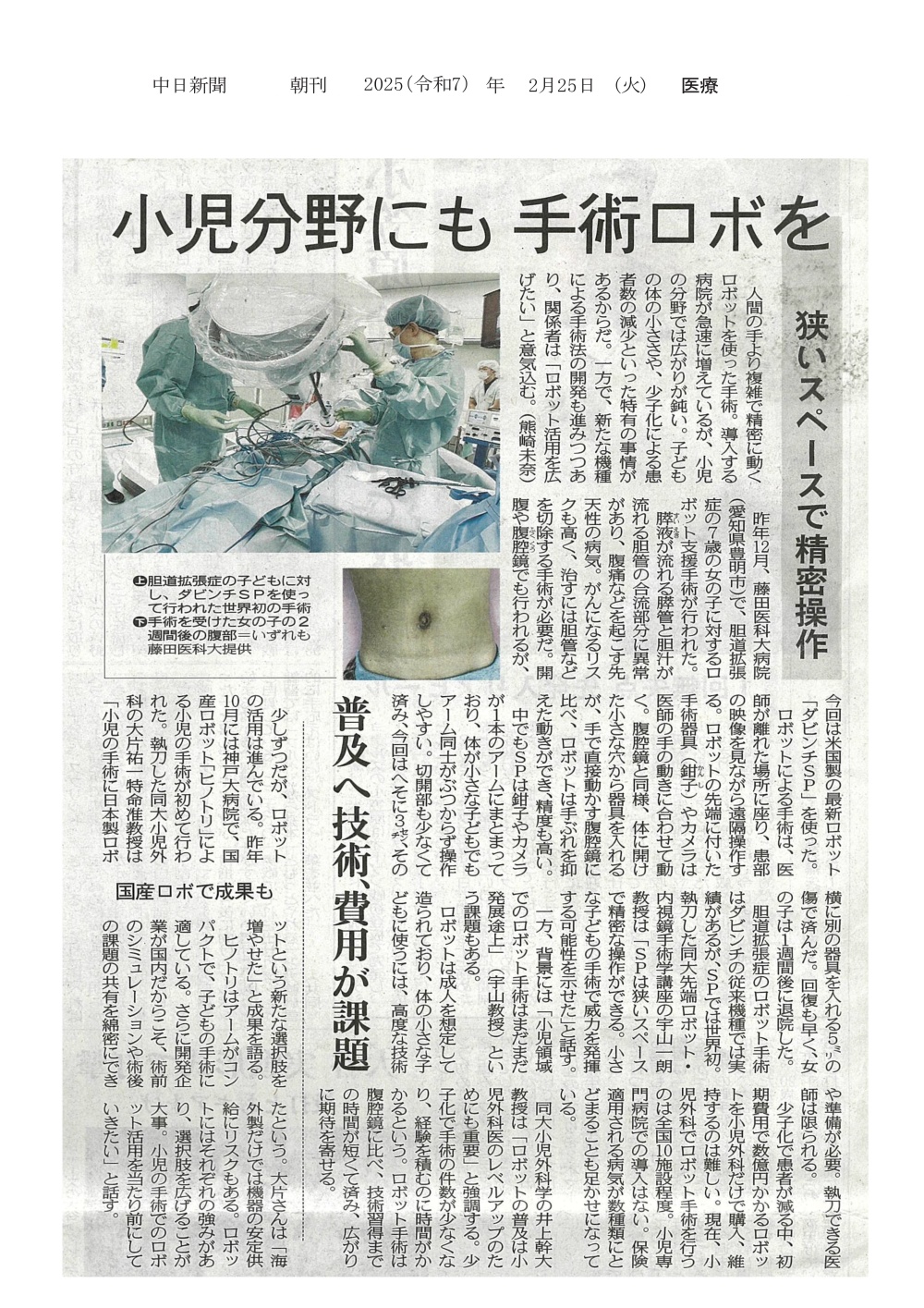 本学病院で胆道拡張症の女児に対するロボット支援手術が行われたことが2025年2月25日中日新聞（朝刊）に掲載されました