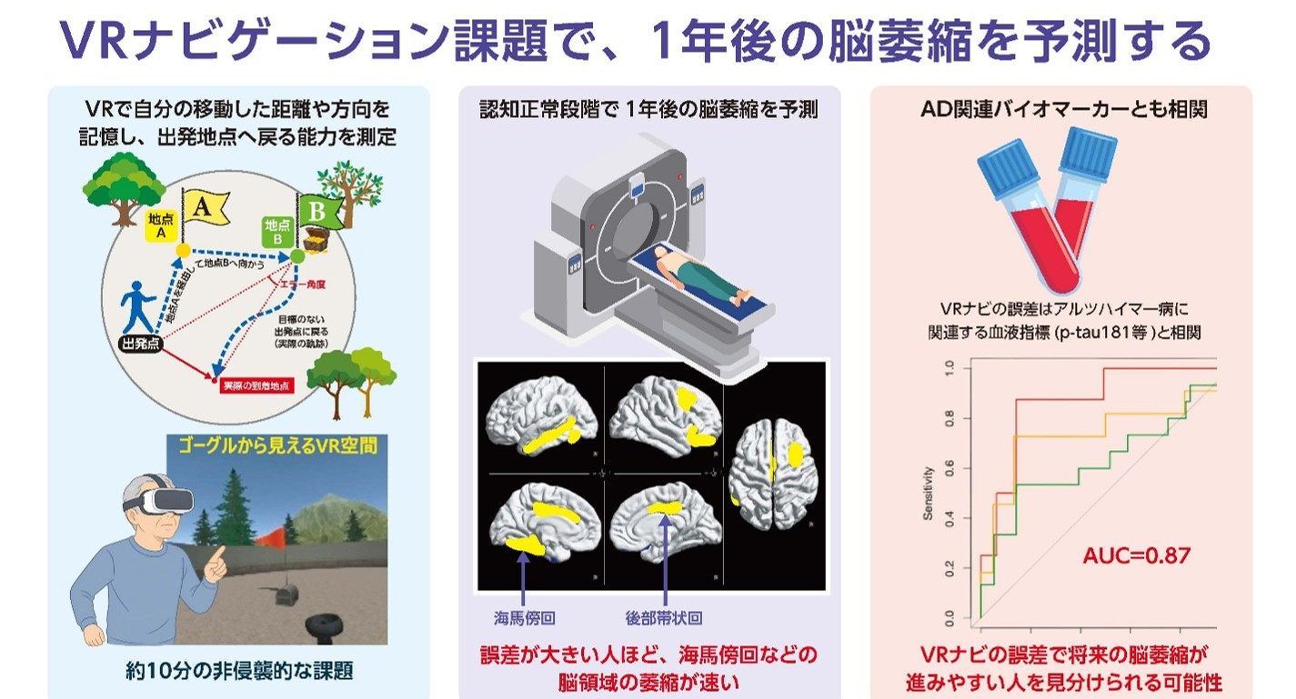 3D VRナビ課題の評価が1年後の脳萎縮を予測 — 認知機能が正常な段階で、認知症の超早期変化を捉える新規手法 —