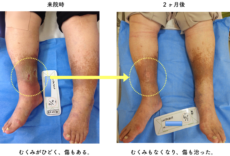 効果ありますか?
